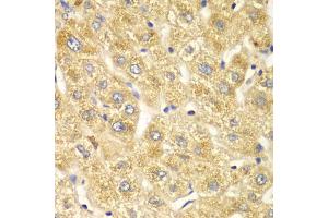 Immunohistochemistry of paraffin-embedded human liver injury using OGT antibody (ABIN4904611) at dilution of 1:100 (40x lens). (OGT 抗体)