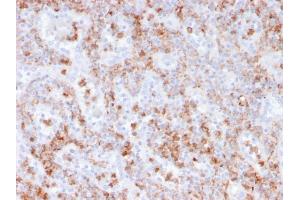 Formalin-fixed, paraffin-embedded human spleen stained with S100A9 Recombinant Mouse Monoclonal Antibody (rMAC3781). (Recombinant S100A8 抗体)