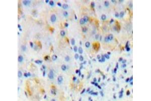 IHC-P analysis of Liver tissue, with DAB staining. (Oncostatin M Receptor 抗体  (AA 503-749))