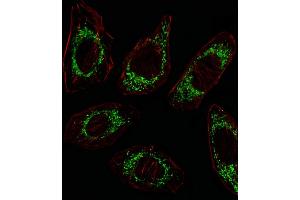 Fluorescent image of A549 cell stained with OAT Antibody (N-term) (ABIN652844 and ABIN2842548)/SA100310AG.