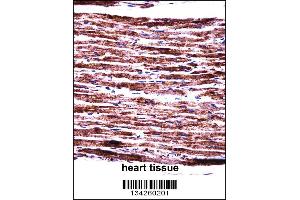 PERP Antibody immunohistochemistry analysis in formalin fixed and paraffin embedded human heart tissue followed by peroxidase conjugation of the secondary antibody and DAB staining. (PERP 抗体  (C-Term))
