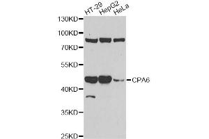 Western blot analysis of extracts of various cell lines, using CPA6 antibody. (CPA6 抗体)