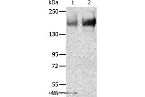 Western blot analysis of Human jejunoileum and ileum tissue, using TRPM6 Polyclonal Antibody at dilution of 1:200 (TRPM6 抗体)