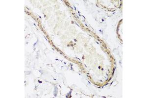 Immunohistochemistry of paraffin-embedded human colon using CAV3 antibody (ABIN5974782) at dilution of 1/200 (40x lens). (Caveolin 3 抗体)