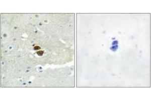 Immunohistochemistry analysis of paraffin-embedded human brain, using n-NOS (Phospho-Ser852) Antibody. (NOS1 抗体  (pSer852))