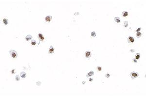 anti-Forkhead Box C2 (MFH-1, Mesenchyme Forkhead 1) (FOXC2) (AA 215-265) antibody