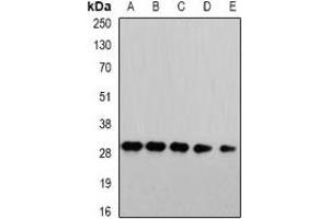 Western blot analysis of PSMA4 expression in HepG2 (A), Jurkat (B), mouse liver (C), COS7 (D), PC12 (E) whole cell lysates. (PSMA4 抗体)