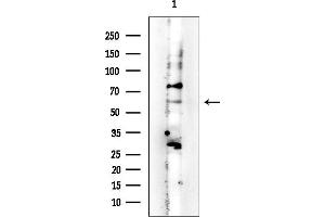 Western blot analysis of lysates from Rat brain, using PAK1 Mouse Monoclonal Antibody at 1/1000 dilution.