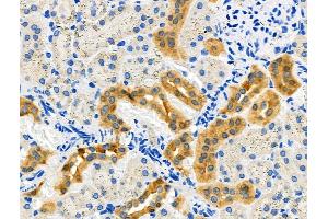 ABIN6264127 and ABIN6276381 at 1/100 staining Rat kidney tissue by IHC-P. (PEBP1 抗体  (C-Term))