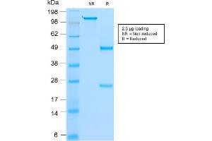 SDS-PAGE Analysis Purified MyoD1 Mouse Recombinant Monoclonal Antibody (rMYD712). (Recombinant MYOD1 抗体)