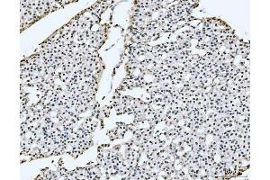 IHC analysis of PC4/SUB1 using anti-PC4/SUB1 antibody (ABIN7602186).