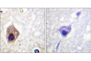 Immunohistochemistry analysis of paraffin-embedded human brain tissue, using Caspase 1 (Ab-376) Antibody. (Caspase 1 抗体  (AA 342-391))