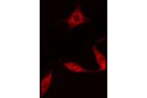 ABIN6278006 staining  HuvEc cells by IF/ICC. (DAPK3 抗体  (Internal Region))