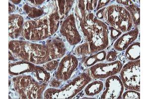 Image no. 7 for anti-Phosphatidylinositol-4-Phosphate 3-Kinase, Catalytic Subunit Type 2 beta (PIK3C2B) antibody (ABIN1500199)