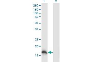 Western Blot analysis of SOD1 expression in transfected 293T cell line by SOD1 monoclonal antibody (M04), clone 10D5. (SOD1 抗体  (AA 1-154))