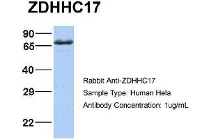 Host:  Rabbit  Target Name:  ZDHHC17  Sample Type:  Hela  Antibody Dilution:  1. (ZDHHC17 抗体  (Middle Region))