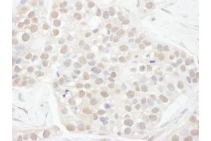 anti-Cyclin T1 (CCNT1) (AA 425-475) antibody