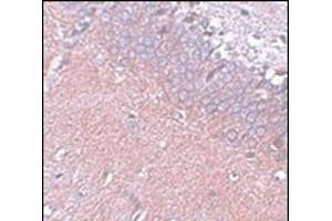 Immunohistochemistry of SYNGR4 in rat brain tissue with this product at 5 μg/ml (SYNGR4 抗体  (N-Term))