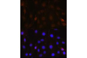 Immunofluorescence analysis of C6 cells using NRBF2 Rabbit pAb  at dilution of 1:100 (40x lens).