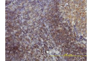 Immunoperoxidase of monoclonal antibody to SH3GLB1 on formalin-fixed paraffin-embedded human tonsil tissue.