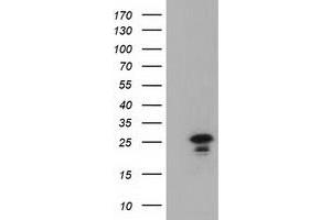 Image no. 2 for anti-Lin-7 Homolog B (LIN7B) antibody (ABIN1499155) (LIN7B 抗体)