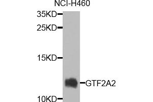 Western blot analysis of extracts of NCI-H460 cells, using GTF2A2 antibody (ABIN5974759) at 1/1000 dilution. (GTF2A2 抗体)