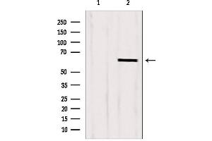Western blot analysis of extracts from HepG2, using CKAP4 antibody. (CKAP4 抗体  (C-Term))