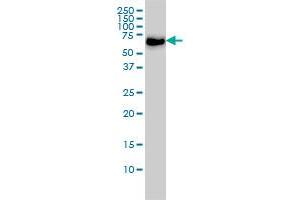 CARF monoclonal antibody (M02), clone 1A6 Western Blot analysis of CARF expression in Hela S3 NE . (CDKN2AIP 抗体  (AA 1-579))