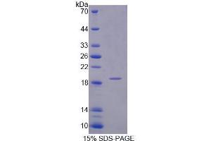 SDS-PAGE analysis of Human INPP4A Protein. (INPP4A 蛋白)