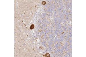 Immunohistochemical staining of human cerebellum with LRRC15 polyclonal antibody  shows strong cytoplasmic positivity in Purkinje cells at 1:20-1:50 dilution. (LRRC15 抗体)