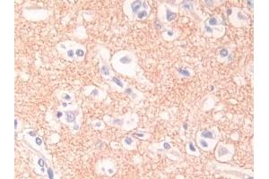 Detection of DSC1 in Human Cerebrum Tissue using Polyclonal Antibody to Desmocollin 1 (DSC1) (Desmocollin 1 抗体  (AA 486-686))
