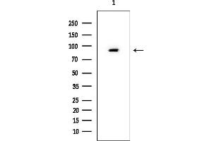 Western blot analysis of lysates from Mouse liver, using KCNQ1 Mouse Monoclonal Antibody at 1/1000 dilution.