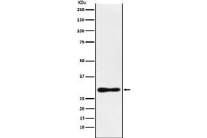 Western blot analysis of DDAH2 expression in MCF7 cell lysate.