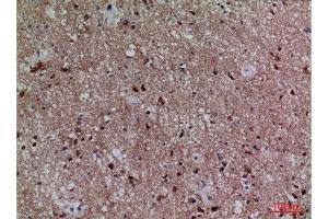 Immunohistochemistry (IHC) image for anti-Cell Division Cycle 34 (CDC34) (Internal Region) antibody (ABIN3187727)