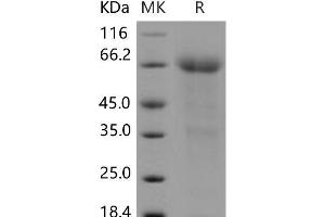 Western Blotting (WB) image for Protein C Receptor, Endothelial (PROCR) protein (Fc Tag) (ABIN7320124)