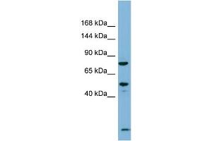 Host:  Rabbit  Target Name:  PDZRN3  Sample Type:  Fetal Thymus lysates  Antibody Dilution:  1. (PDZRN3 抗体  (N-Term))