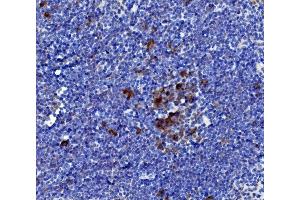 IHC analysis of IL-21/Il21 using anti-IL-21/Il21 antibody (ABIN7600316).