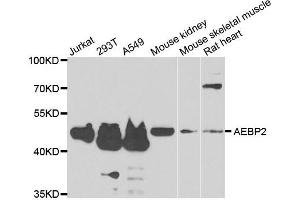 Western blot analysis of extracts of various cell lines, using AEBP2 antibody. (AEBP2 抗体)