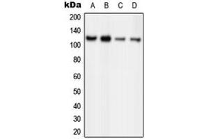 Western blot analysis of ORC1 expression in HeLa (A), MCF7 (B), PC12 (C), Ramos (D) whole cell lysates. (ORC1 抗体  (Center))