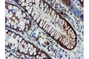 Immunohistochemical staining of paraffin-embedded Human colon tissue using anti-PPAT mouse monoclonal antibody. (PPAT 抗体  (AA 42-278))