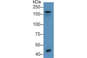 Detection of C3 Convertase in Human Serum using Monoclonal Antibody to Complement C3 Convertase (C3 Convertase) (Complement C3 Convertase 抗体)