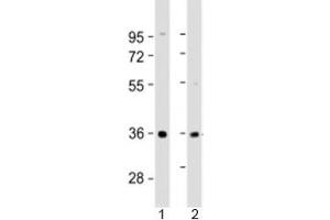 Western blot testing of human 1) liver and 2) SK-BR-3 cell lysate with AKR7A3 antibody at 1:2000.