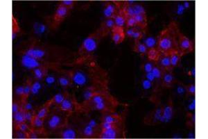 Immunofluorescence (IF) image for anti-Integrin, alpha 6 (ITGA6) antibody (ABIN2664749) (ITGA6 抗体)