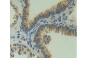 Used in DAB staining on fromalin fixed paraffin- embedded Kidney tissue (PLEKHA1 抗体  (AA 105-351))