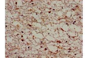 Immunohistochemistry (IHC) image for anti-Sortilin-Related Receptor, L(DLR Class) A Repeats Containing (SORL1) (AA 525-744) antibody (ABIN7170339)