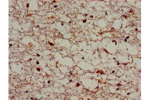 Immunohistochemistry of paraffin-embedded human brain tissue using ABIN7170339 at dilution of 1:100 (SORL1 抗体  (AA 525-744))