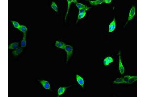 Immunofluorescent analysis of Hela cells using ABIN7175097 at dilution of 1:100 and Alexa Fluor 488-congugated AffiniPure Goat Anti-Rabbit IgG(H+L) (UNG 抗体  (AA 114-224))