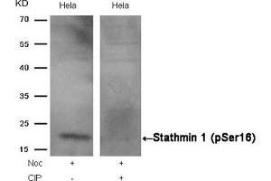 Western blot analysis of extracts from Hela cells, treated with Noc or calf intestinal phosphatase (CIP), using Stathmin 1 (Phospho-Ser16) Antibody. (Stathmin 1 抗体  (pSer16))