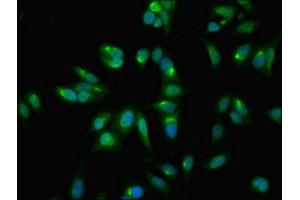 Immunofluorescent analysis of Hela cells using ABIN7153422 at dilution of 1:100 and Alexa Fluor 488-congugated AffiniPure Goat Anti-Rabbit IgG(H+L) (GALT 抗体  (AA 1-379))