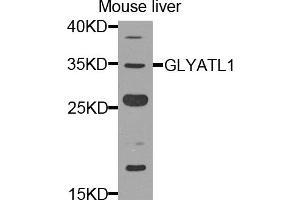 Western blot analysis of extracts of mouse liver, using GLYATL1 antibody. (GLYATL1 抗体)
